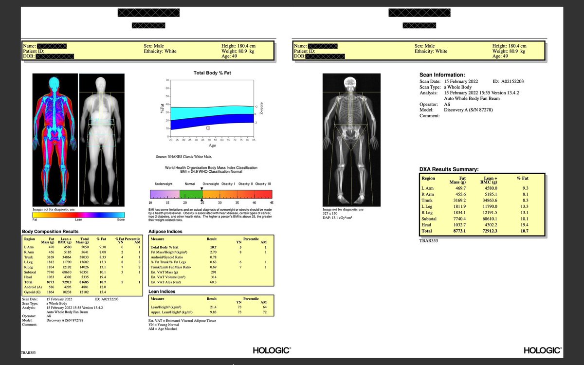 DrMGSchmidt's tweet photo. @AmandaMGoetz Nice work!!! Looking good! I had a DEXA two years ago. Plan on having another one in the next couple months. So helpful to track your metrics over time. https://t.co/g5KTvU9CWh