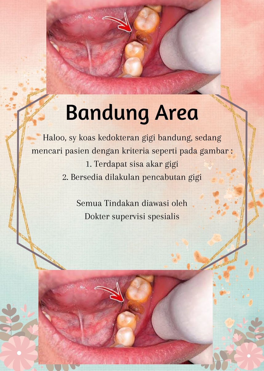 Muffincakee8_'s tweet photo. Bisa langsung comment/message yaa untuk konsultasii, yukk jaga kesehatan gigi dan mulut sebelum menjadi sumber infeksi lainnya #koasgigibandung #cabutgigi #pasiencabutgigi #Bandung #pasienkoasgigi #butuhpasien #cabutgigi https://t.co/QwWTvIeHpA
