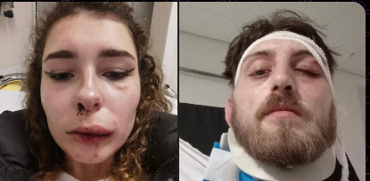 UltraDane's tweet image. A French couple was attacked by a gang of North Africans last week in Toulouse. The gang made remarks to the girl and when her boyfriend stepped in they attacked both of them, the man has a fractured eye socket and the girl has missing teeth and bruises.