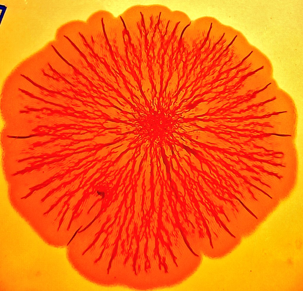 Blossoming Microcosm: 'Escherichia coli' blooms into a delicate flower-like pattern on the vibrant canvas of Congo Red agar plate, showcasing the artistry of unseen life forms.
