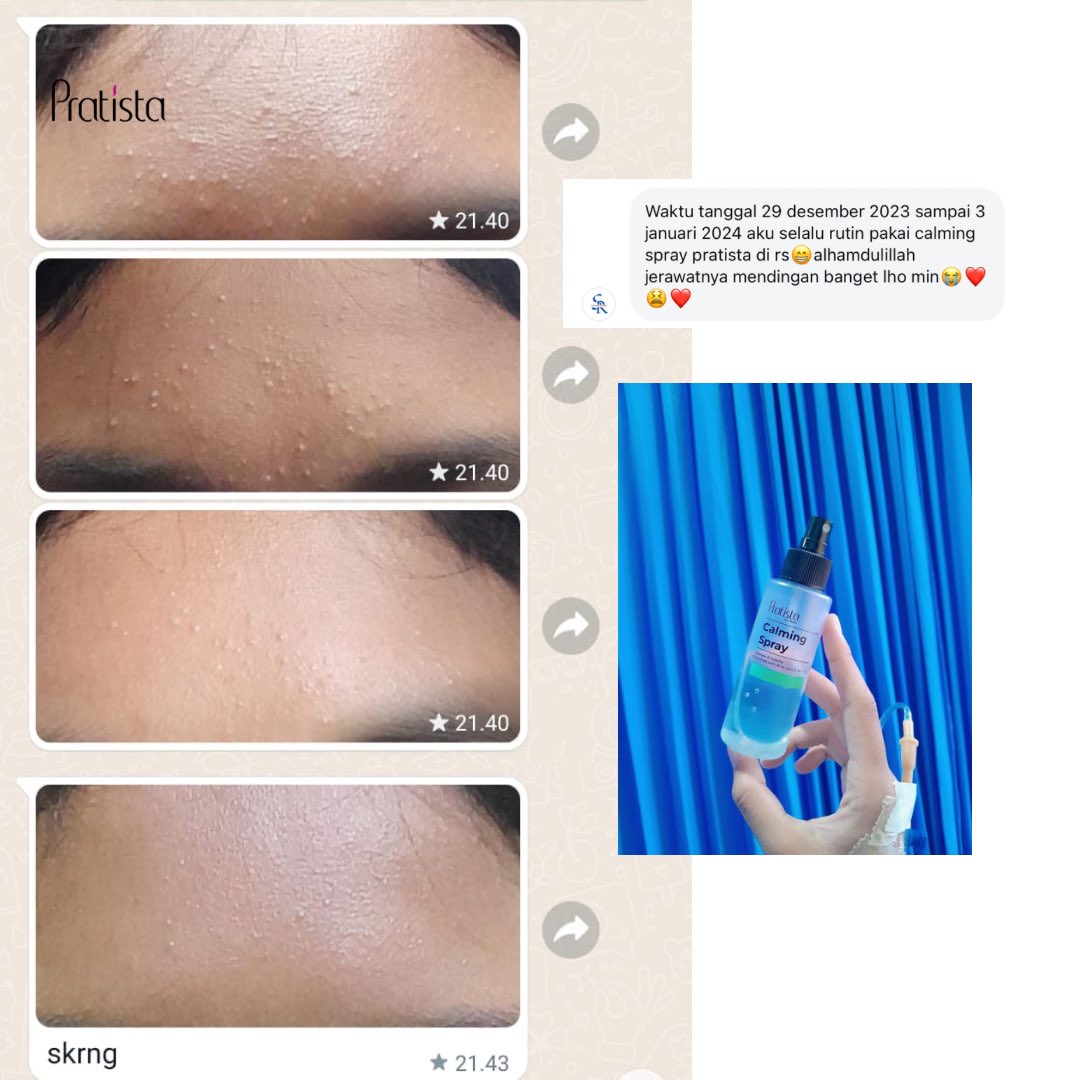 pratistaofc's tweet photo. MinSta mengucapkan banyak-banyak Terimakasih buat kalian yang selalu effort setiap share testimoni🥹😭💖

Sehat selalu&amp;bahagia semuanya!!🫂💞
#pratistaskincare #calmingspray #facemistpratista https://t.co/CwN8hKYpZn