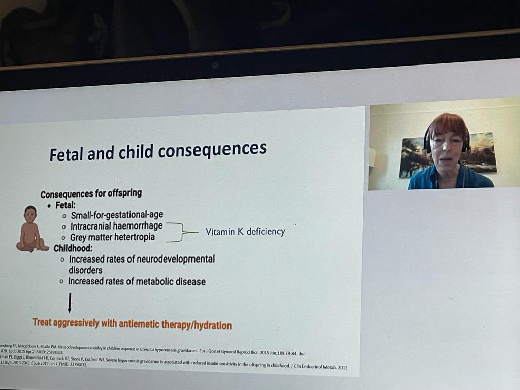 Melanie Nana (@melanie_nana1) on Twitter photo HG has consequences for mother & fetus- it must be treated aggressively to avoid these adverse outcomes
New <a href="/RCObsGyn/">RoyalCollegeObsGyn</a> due for publication early Feb @ 1 page summary for ED (endorsed by <a href="/RCEMpresident/">Adrian Boyle</a> <a href="/RCEMLearning/">RCEMLearning</a>) can be found in appendix
<a href="/cathwilliamson5/">Catherine Williamson</a> @nelson_piercy HG has consequences for mother & fetus- it must be treated aggressively to avoid these adverse outcomes
New <a href="/RCObsGyn/">RoyalCollegeObsGyn</a> due for publication early Feb @ 1 page summary for ED (endorsed by <a href="/RCEMpresident/">Adrian Boyle</a> <a href="/RCEMLearning/">RCEMLearning</a>) can be found in appendix
<a href="/cathwilliamson5/">Catherine Williamson</a> @nelson_piercy