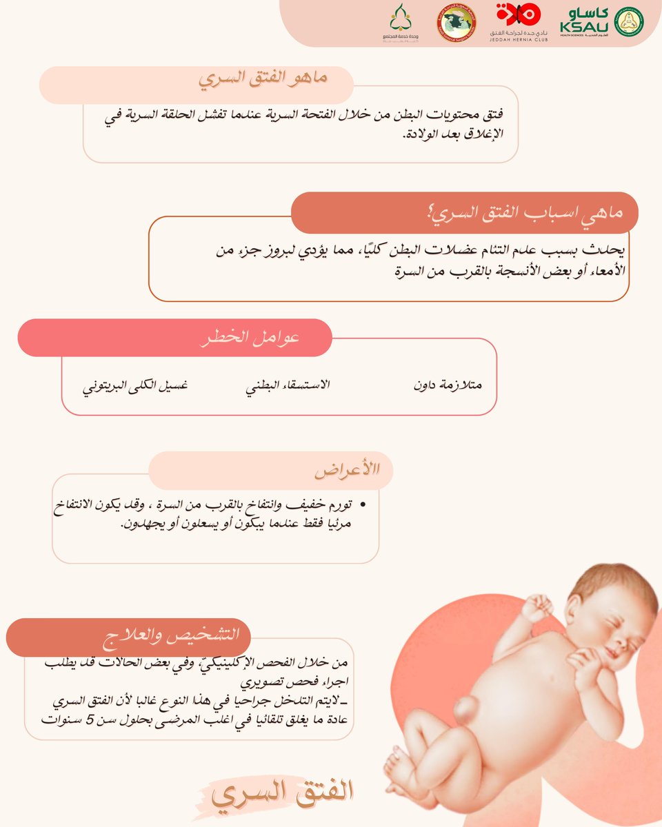 <a href="/SGSS_KSA/">SGSS</a> ما هو الفتق السري للأطفال؟

#كساو
#كلية_الطب
#جدة
#SGSS
#خدمة_المجتمع 
#فتق