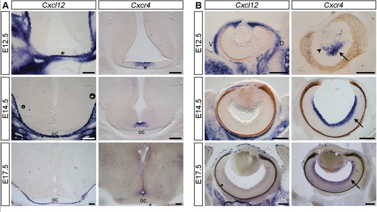Getting your wires crossed: CXCL12 guides optic pathway development

Read this Research Highlight showcasing work from Viet-Hang Le, Christiana Ruhrberg <a href="/RuhrbergLab/">Ruhrberg lab</a>, Lynda Erskine <a href="/aberdeenuni/">University of Aberdeen</a> and colleagues:

journals.biologists.com/dev/article/15…