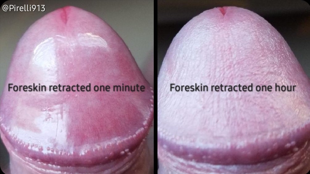 4skinFriendly's tweet photo. Turned this into a meme pic for those who want to share outside of Twitter/X. #i2 https://t.co/7kjVgWHdFI
