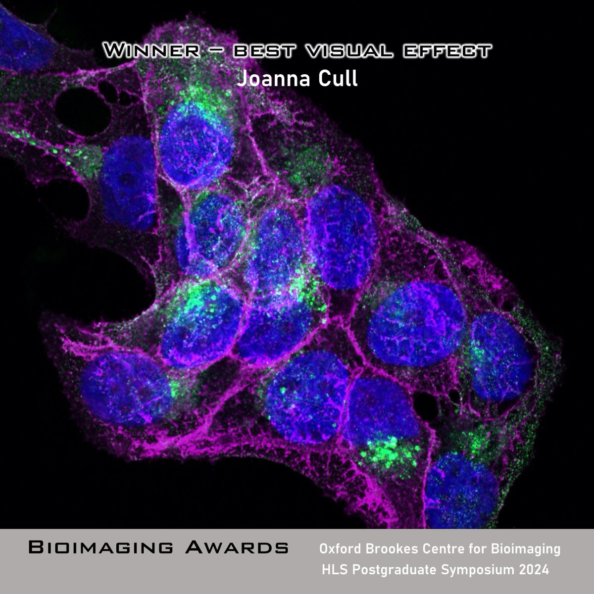 Oxford Brookes Centre for Bioimaging (@obcbioimaging) on Twitter photo Congratulations to the winners of the BioImaging Awards at the <a href="/brookeshls/">Oxford Brookes HLS</a> Graduate Symposium 2024 and thanks to everyone who submitted their great images! Congratulations to the winners of the BioImaging Awards at the <a href="/brookeshls/">Oxford Brookes HLS</a> Graduate Symposium 2024 and thanks to everyone who submitted their great images!