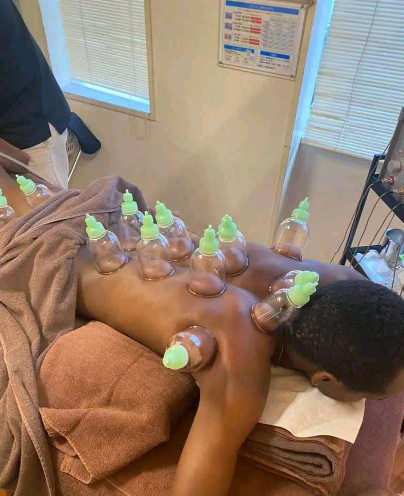 We are smart to go now with cupping therapy #healingmethod that may ease pain.
#Byepain #MindAndBodyWellness #Breathingexercise #bloodpresure