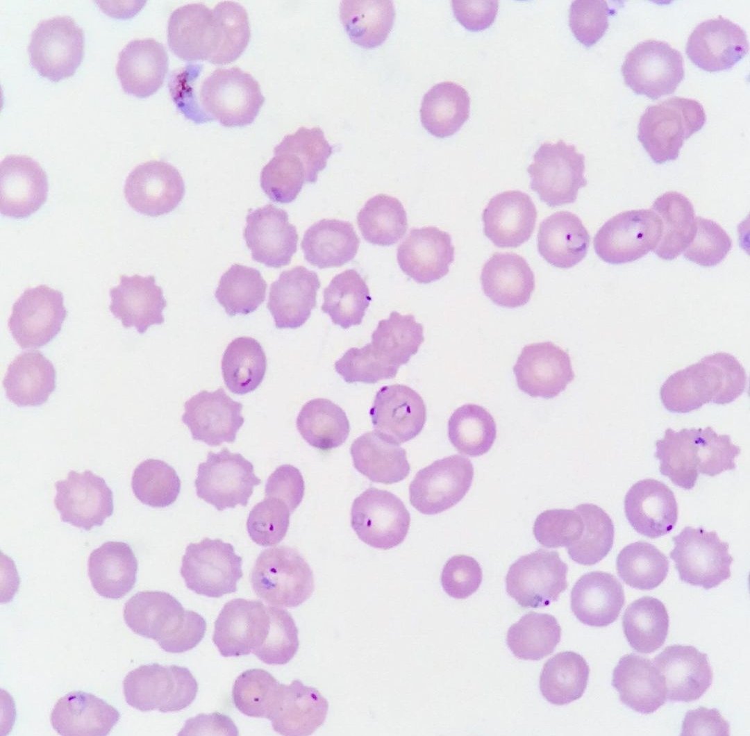 mICROBIOsh's tweet photo. Plasmodium falciparum 🍌💍 https://t.co/fIlhl9qRRt