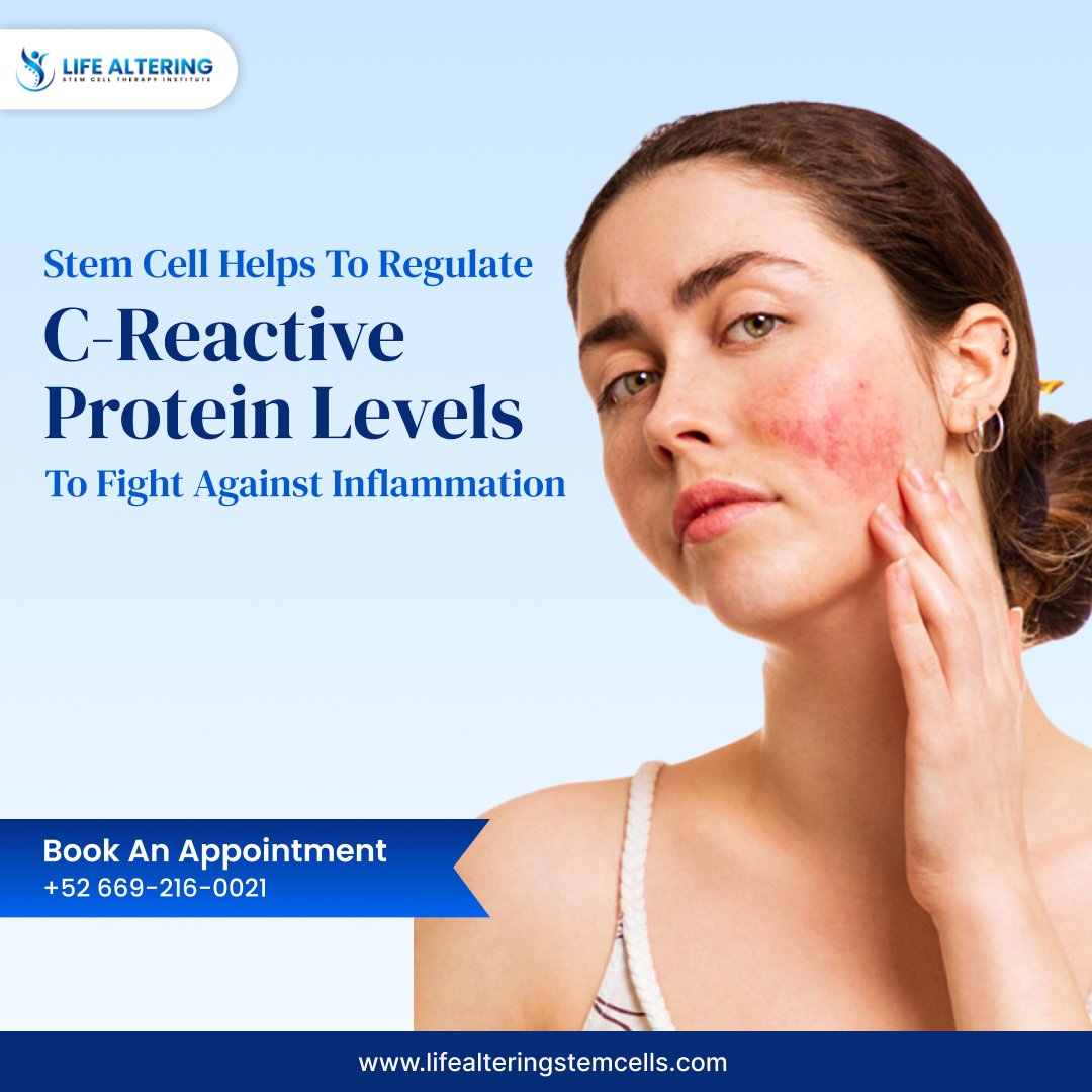 LifeAlteringT's tweet image. Elevate your healthcare game with Stem Cell wonders! 

Experience the magic of regulated C-reactive protein. 

Say NO to inflammation and YES to a proactive life! 

Visit us: bit.ly/48yn6os 

#WebgenTechnologies #StemCell #Inflammation #Proactive #Treatment