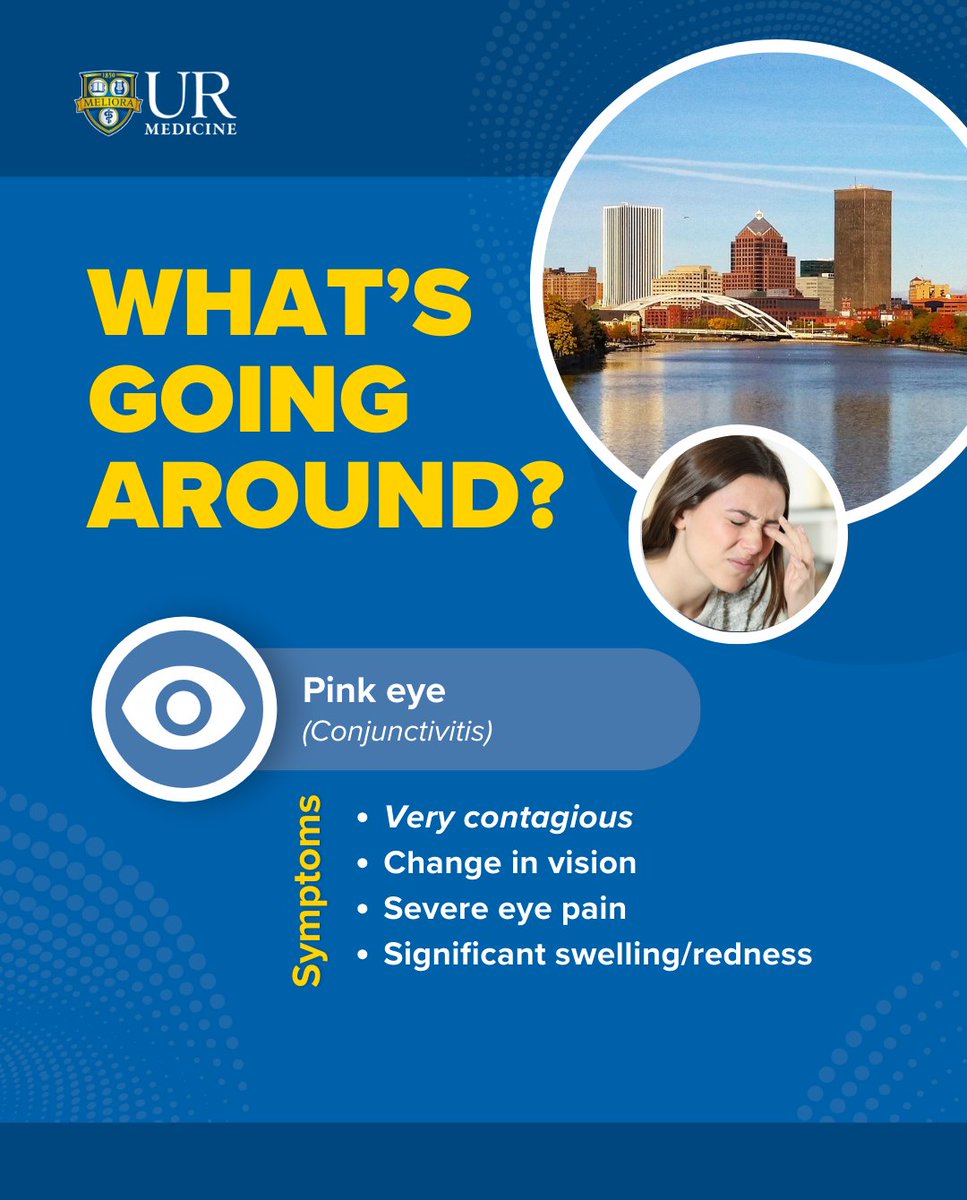 Heads up: 'Pink eye' is going around in our community. #ROC To help prevent the spread: 🧼Wash your hands frequently 🫧Wash bedding and towels in hot water 🖌️Discard eye makeup used while symptomatic 👁️Discard contacts used while symptomatic