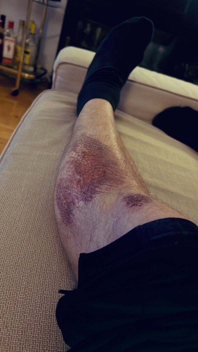 En friendly reminder till er som tränar på konstgräs just nu, låt bli att glidtackla!