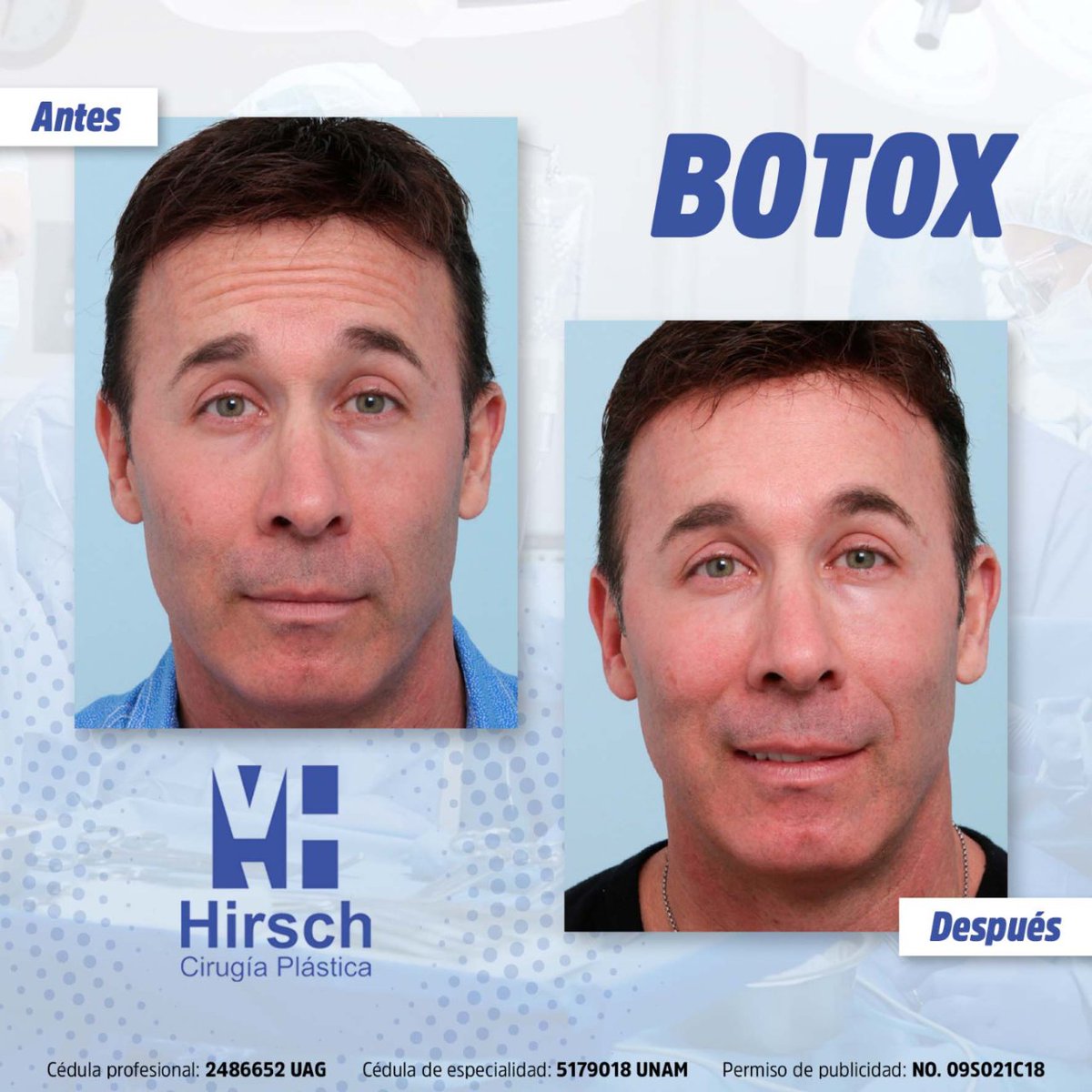 PlastikMike's tweet photo. Elimina las arrugas de tu rostro con el Botox ✨😌

Si quieres saber más: https://t.co/Rl7bi6N4AJ
💻

Mi facebook 📲https://t.co/nLfLk1ndSy

#doctor #certificado #cirugia #plastica #reconstructiva #cita https://t.co/QzMV79RxMe