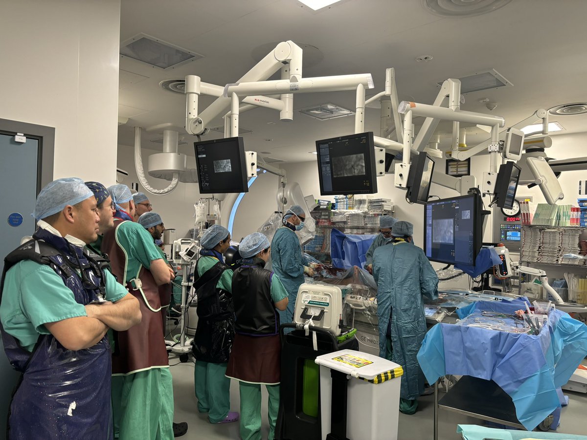 Cook FEVAR ESVS masterclass. 4 vessel FEVAR (unstented coeliac) complex live case with short distance between right renal artery and SMA at same level. Great to see strategies such as steerable sheath to aid cannulation.