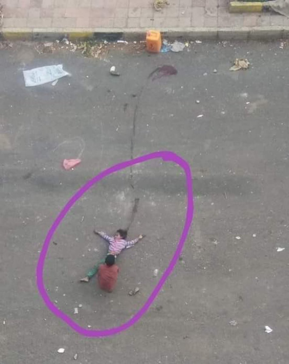 realMaalouf's tweet photo. This Yemeni little girl was shot dead by a Houthi sniper simply because she wasn’t wearing a hijab. Then her brother tried to retrieve her body and was shot as well.

While the radical left, Islamists, and pro-Palestine supporters try to portray the Houthis as 'freedom fighters’, the truth is that among all terrorist groups, the Houthis, alongside the Taliban, have the most extremist ideology.