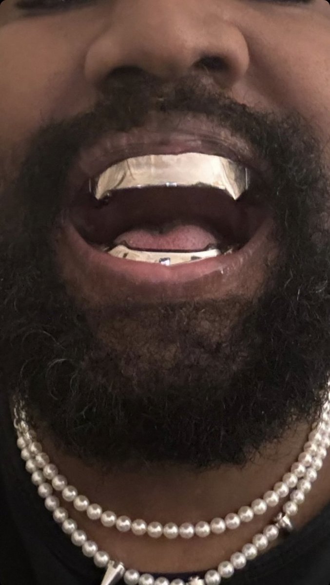 RapMais's tweet photo. 🚨Kanye West remove os dentes e os substitui por próteses de TITÂNIO 'mais caras que diamantes', diz site

O Daily Mail afirma que Kanye West removeu todos seus dentes para por as próteses de titânio Ye postou uma foto dos “novos dentes” no Instagram e se comparou com o vilão Jaws do 007