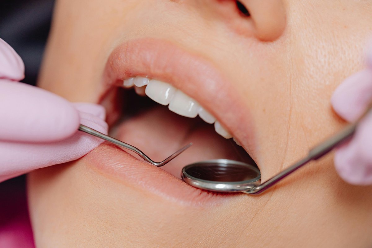 dmd_pena's tweet image. drpenalakewood.com
#LakewoodDentist #IrenePenaDMD #SpectrumMediaGroup #DentalOffice #Toothache #cosmetic #dentistry #bellflower #cerritos #downey #dentist #longbeachdentist #bellflowerdental #lakewood #dental #paramountdentist #norwalk #dentalimplants #crowns #dentures