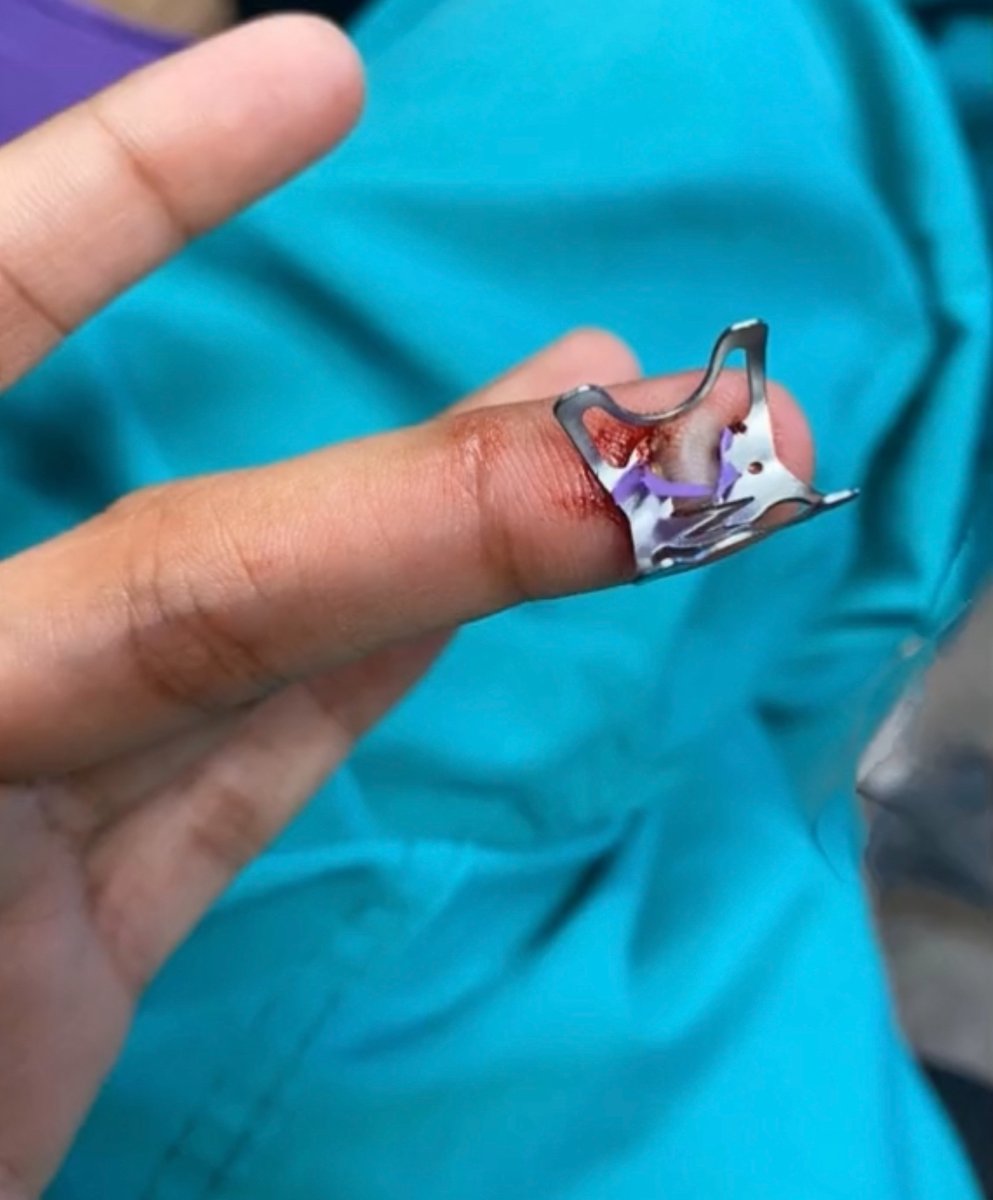 Keith Siau tweet media