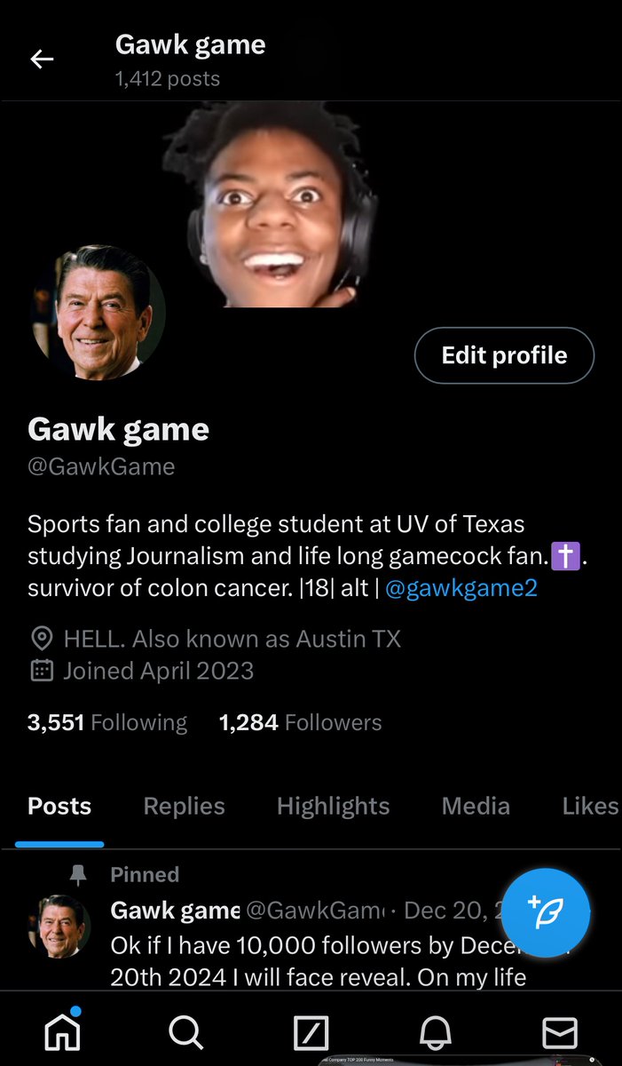 Gawkgame2's tweet image. Look at this loser