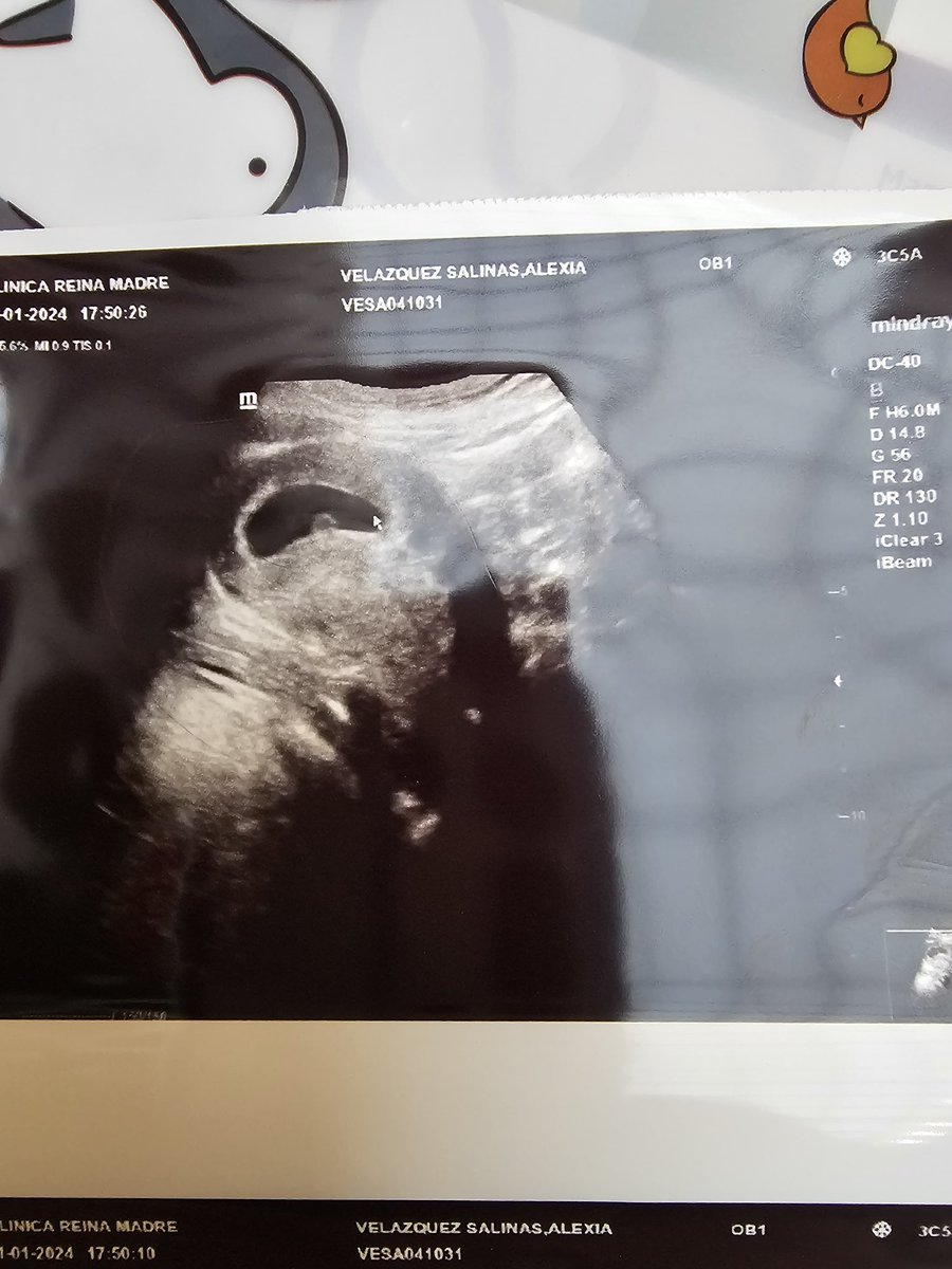 SleeaferMLG tweet media