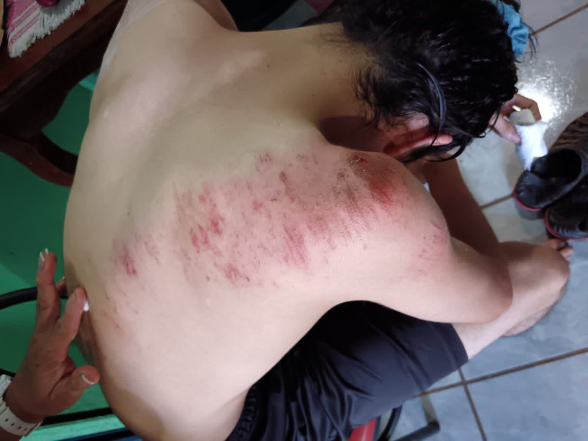 Ahora me llamo Tere ( me ras despiche en bici)