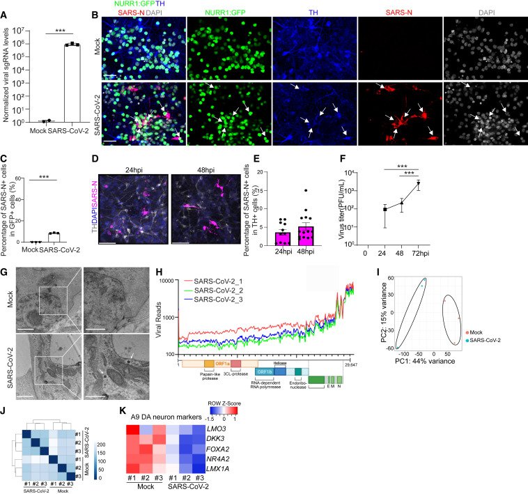guty2370's tweet image. Las neuronas de dopamina (DA) del mesencéfalo derivadas de células madre pluripotentes humanas (hPSC) son selectivamente susceptibles y permisivas a la infección por #SCV2 
La infección por #SCV2 de las neuronas DA desencadena una respuesta inflamatoria y de senescencia celular.