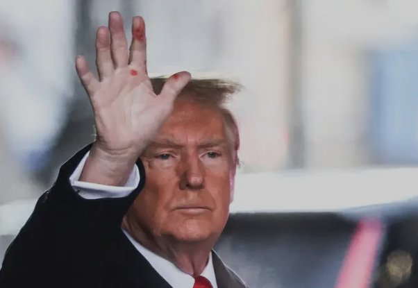 What the hell is wrong with Trump's hand?