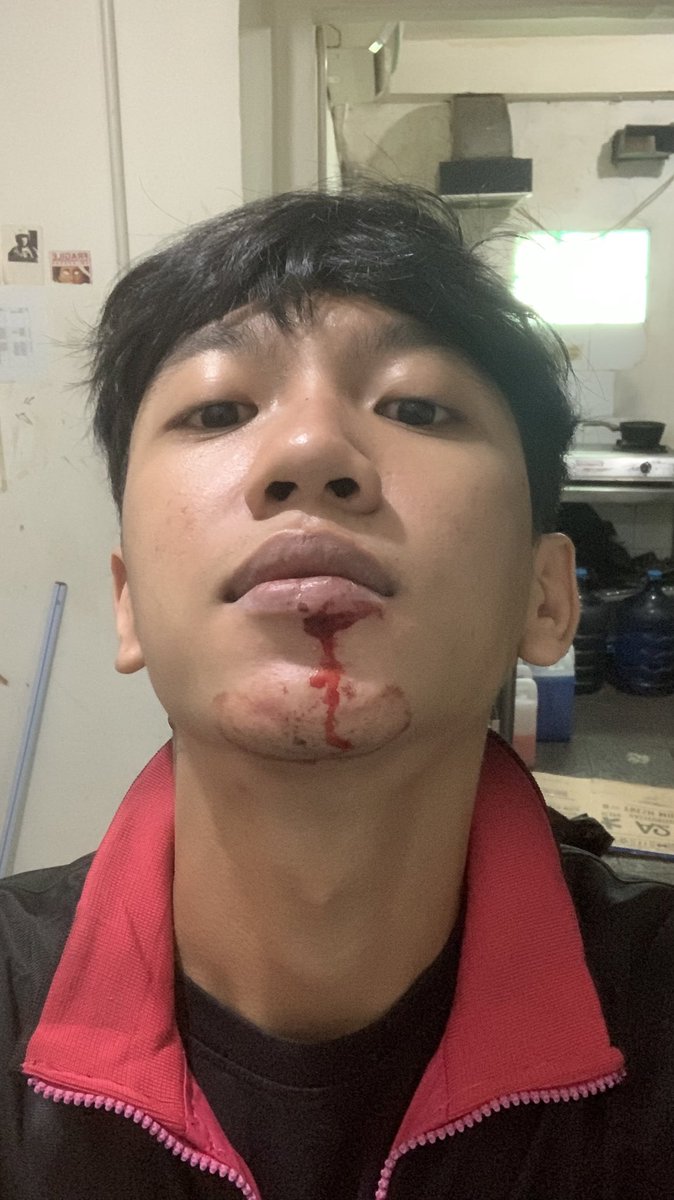 luleforsale's tweet photo. banner caleg anjing bibir gw robek ngentot https://t.co/CR41jsyHTM