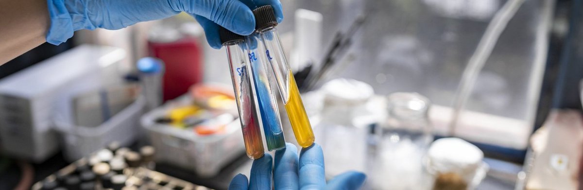 Int. Centre for Antimicrobial Resistance Solutions (@icars_global) on Twitter photo 🔬 <a href="/WHO/">World Health Organization (WHO)</a> is inviting microbiologists, infectious diseases clinicians, and laboratory health systems experts to contribute to the development of a crucial "Model List of Essential Bacteriology and Mycology Diagnostic Tests." Access the survey here ➡️ who.int/news-room/arti… 🔬 <a href="/WHO/">World Health Organization (WHO)</a> is inviting microbiologists, infectious diseases clinicians, and laboratory health systems experts to contribute to the development of a crucial "Model List of Essential Bacteriology and Mycology Diagnostic Tests." Access the survey here ➡️ who.int/news-room/arti…