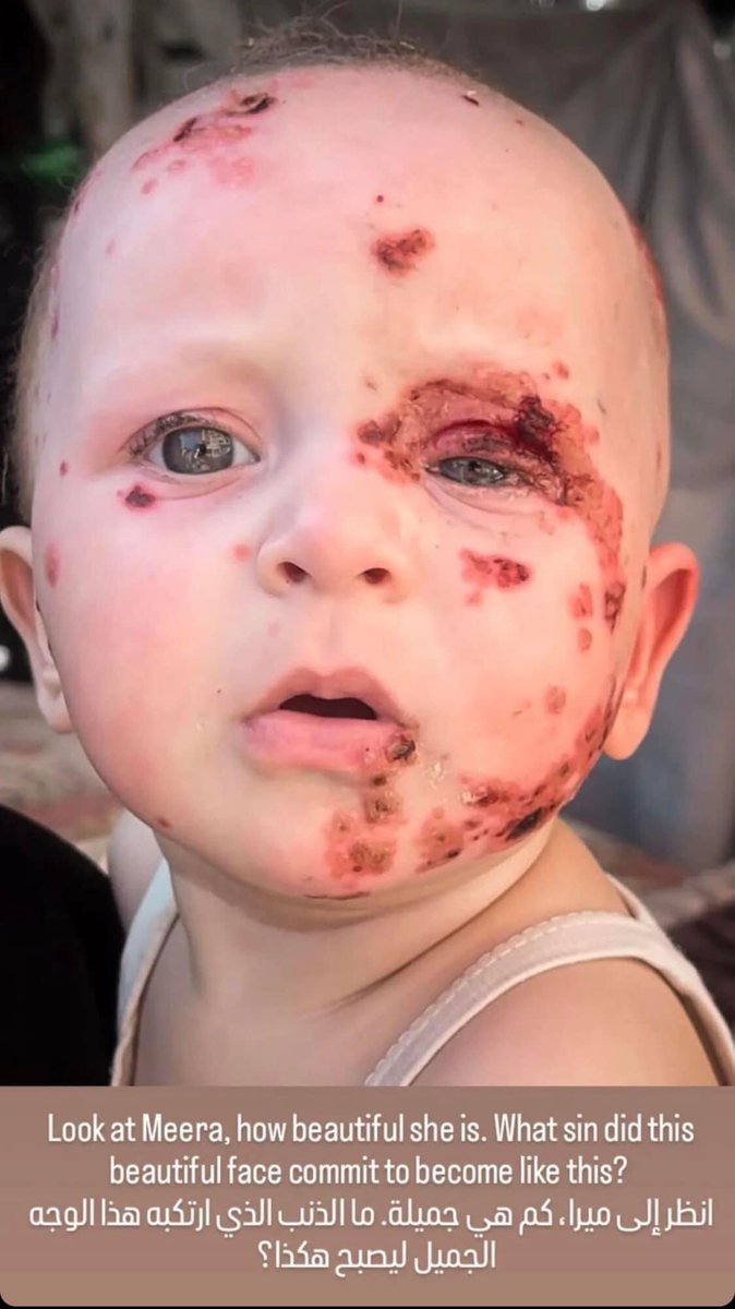 You are so beautiful, Mira. You are so innocent, Mira. Your fault is that you are a Palestinian, and your life has no value to this hypocritical world, Mira. And we were all destined to live under the Nazi terrorist Israeli occupation. But with all these scars and wounds, you
