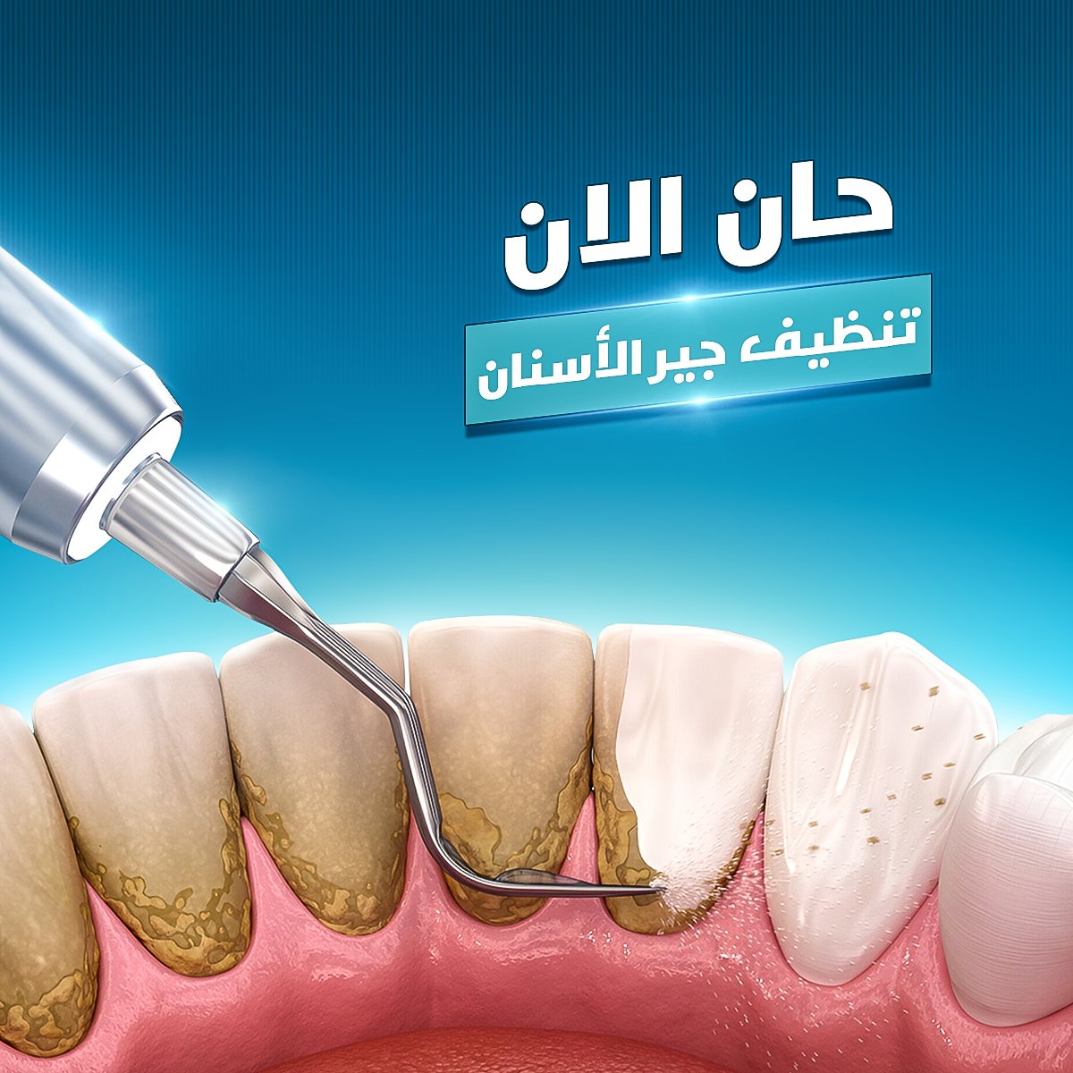 dahihdesign's tweet photo. dental clinic posts❤📷 https://t.co/FUn9mJ93xS…
@BeyondCoffee_sa

@Designers_Sup

@TactusDe1

@dam_designers

@OCreativeJobs

@iDes_Tag

@YOUR_PLATFORMM

@DlelDes

@des_library1

#تجمع_فنانيين٩ #GraphicDesigner #SaudiArabia #GraphicDesigner https://t.co/ljBrUkgyCk
