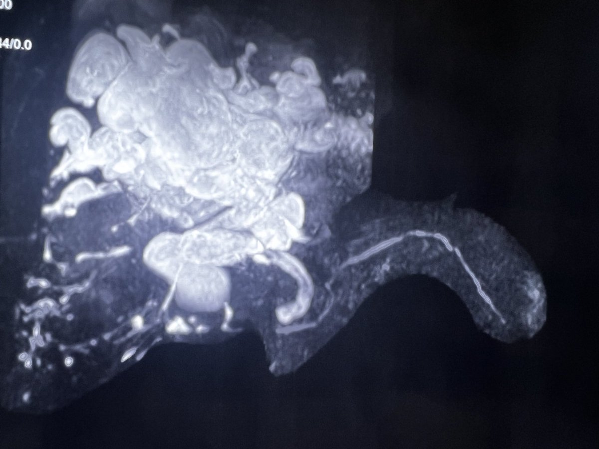 Anand V Kulkarni tweet media