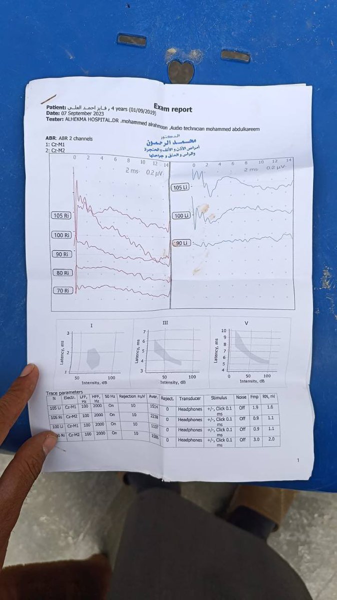 Syrianrev2011's tweet photo. الثقة بالنفس و احترام الذات و التركيز و الذاكرة.

يحتاج إلى سماعات طبية ديجتل
غالية الثمن وبسبب الوضع المادي للعائلة السيئ و عمل والده الذي يعمل بصفة عامل يومي لا يستطيع تامين ثمن السماعات 👇🏻👇🏻يتبع https://t.co/0mcj5DZgo7