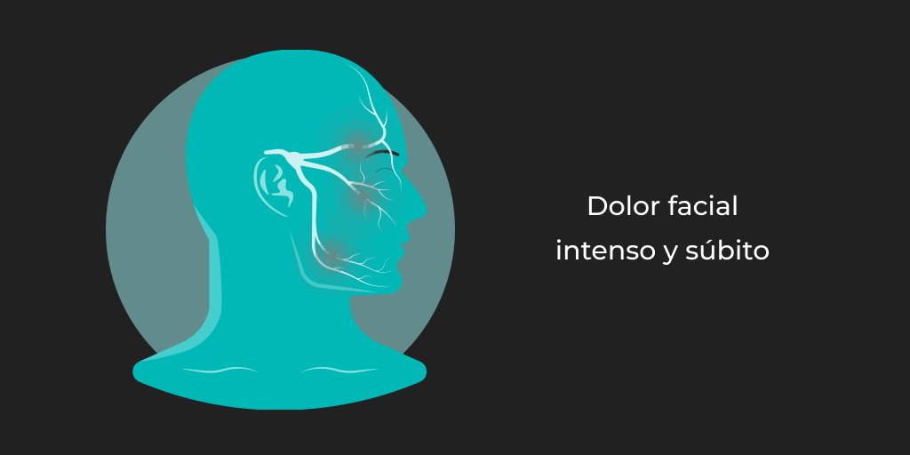 CEN_NEURO's tweet image. 🧠 La #neuralgiadeltrigémino es una afección caracterizada por episodios intensos y súbitos de dolor facial extremadamente agudo y punzante. Estos episodios pueden ser desencadenados por estímulos leves, como tocar el rostro, hablar, comer o cepillarse los dientes.