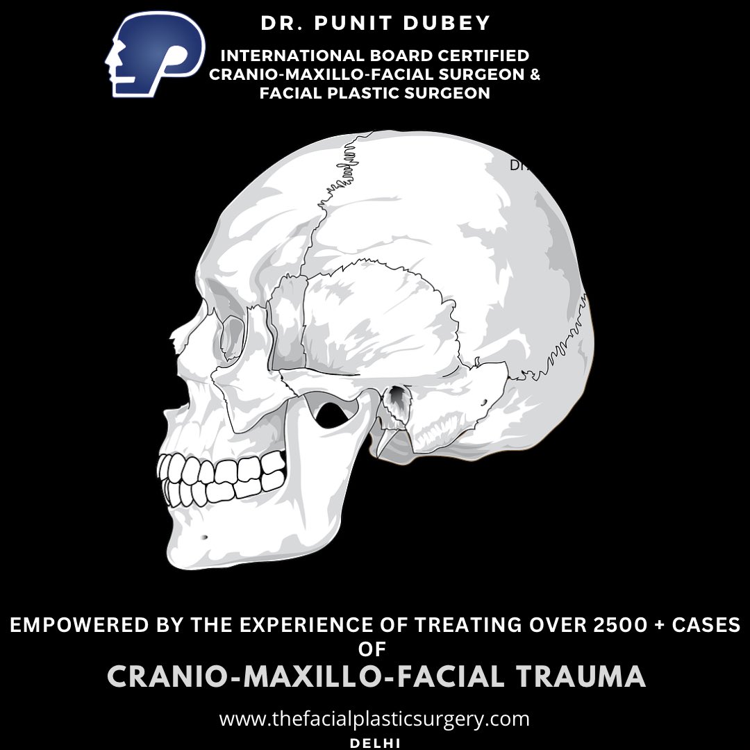 DrPunitDubey's tweet photo. Empowered by the experience of treating over 2500 + cases of Cranio-Maxillo-Facial Trauma. 
Prevent Facial Trauma. Face The Road With A Helmet!

#facialfracturetreatmentindelhi #plasticsurgerydelhi #drpunitdubey  #facialfracturetreatmentdelhi  #roadsafety https://t.co/TLlKW7XDrM