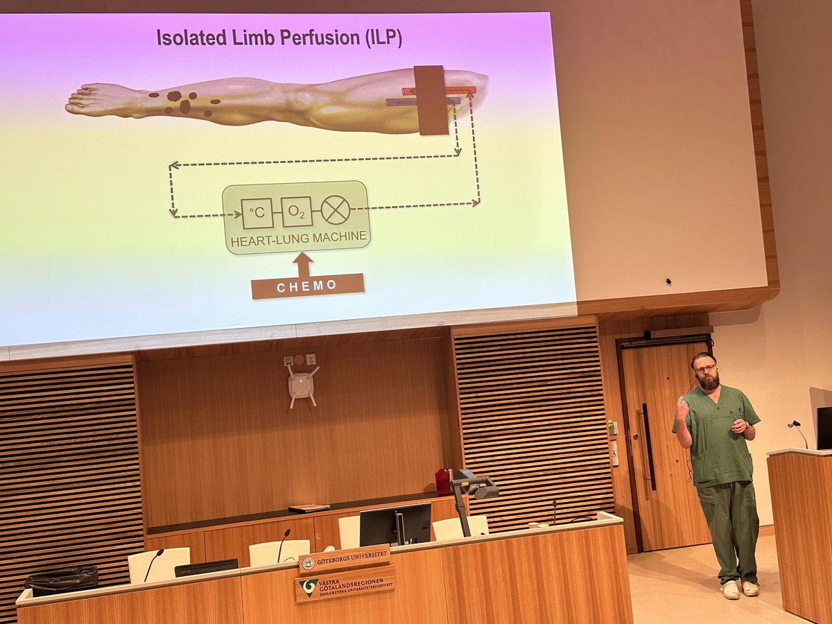 @OlofssonBagge är en av stjärnorna på @sahlgrenska Han och teamet gör världsunika behandlingar mot metastaser på ben/arm/lever efter melanom. Han sköljer koncentrerad varm cytostatika igenom kroppsdelen - sen vittrar metastaserna bort. Ungefär så. #SU_ordföranden #hederssymposiet