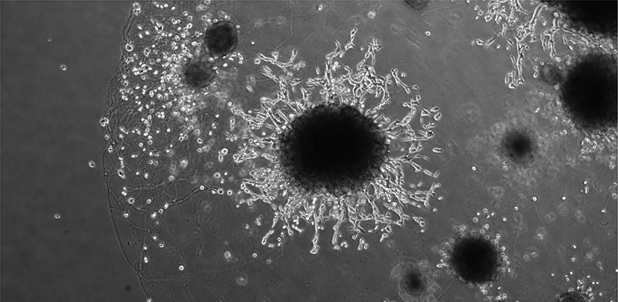 📢 New paper alert!

Congratulations to <a href="/MoffettAm485/">Ashley Moffett</a> and her colleagues for their new paper on trophoblast organoids - here's Ashley explaining how this could help us to understand preeclampsia better:

itv.com/watch/news/dev…

#trophoblast #placenta #organoids #repro

[1/3]