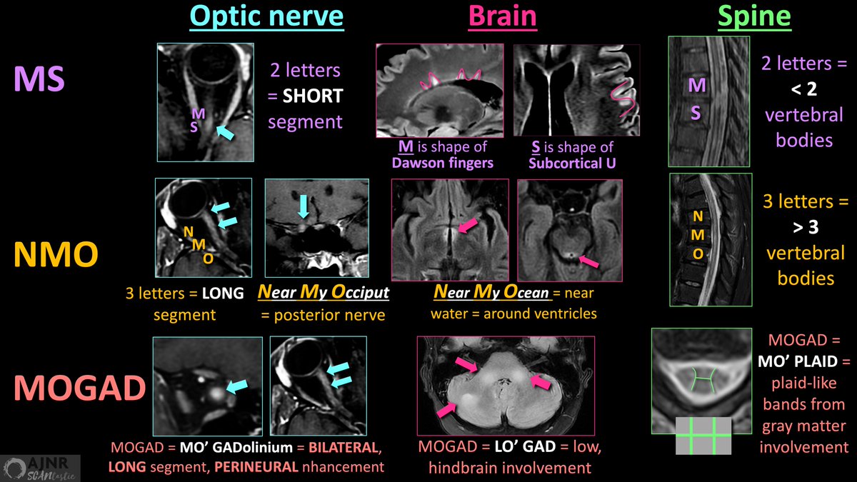 Have MULTIPLE questions about MULTIPLE sclerosis?

Having trouble seeing neuromyelitis optica?

In a fog about MOG?

Here’s the cheat sheet you need to distinguish the demyelinating diseases!

Read on for the newest @theAJNR SCANtastic on demyelination:
ajnr.org/content/45/1/66