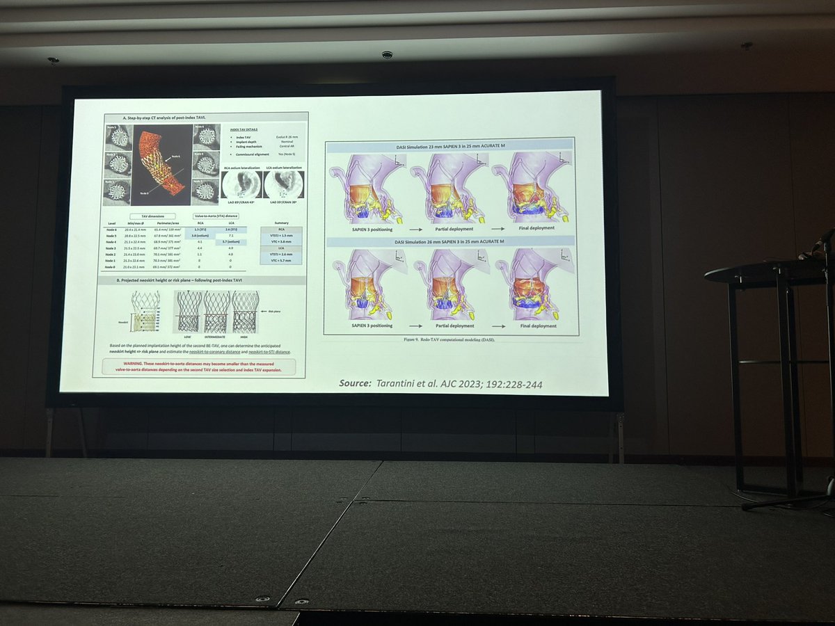 Approaches to TAVR-in-TAVR procedures summarized by <a href="/rajani_dr/">Ronak Rajani</a> as he explores SHD trials at the SCCT #GlobalBudapest meeting