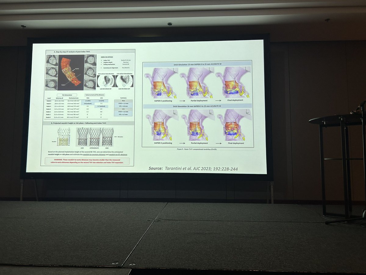 Approaches to TAVR-in-TAVR procedures summarized by @rajani_dr as he explores SHD trials at the SCCT #GlobalBudapest meeting