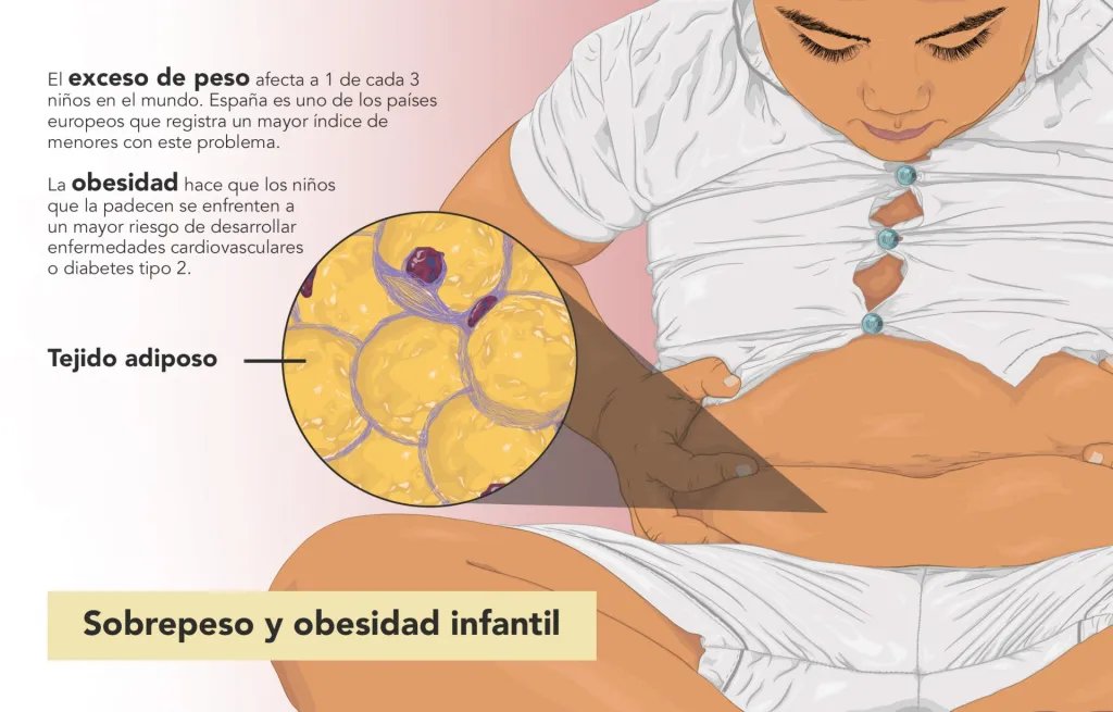 🍏 #UGRinvestiga | Los niños con obesidad pueden reducir su cantidad de grasa y riesgo cardiovascular con sólo 5 meses de ejercicio físico 👟 El estudio #UGR analiza los efectos de un programa de ejercicio aeróbico y de fuerza en escolares con sobrepeso sl.ugr.es/ReduccionObesi…