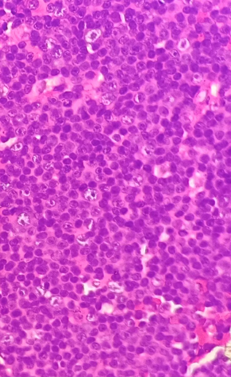 Mutaz Ali, DSc MACSLM tweet media