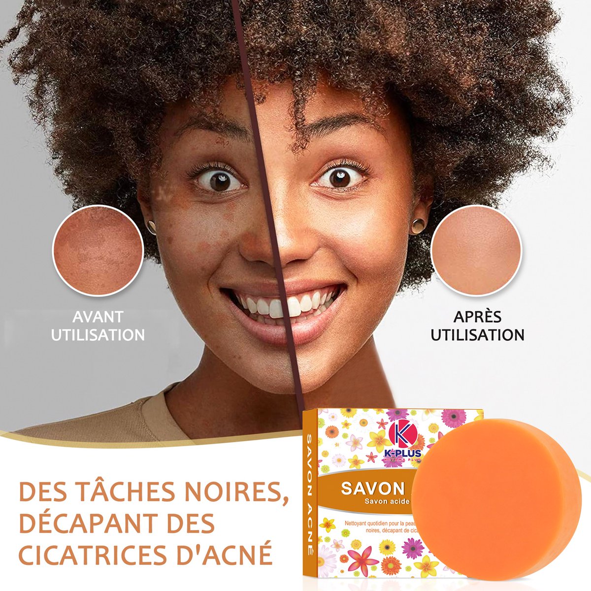 kplusguinee's tweet photo. SAVON ACNÉ OU LA SOLUTION DE VOS BOUTONS. @followers 

Vs avez des acnés, des tâches noires, des cicatrices ou des vergetures ? Ne vs inquiétez plus le savon acné est là pour vs aider. Grâce à ses puissants ingrédients naturels ce savon vs donnera une peau ravissante et éclatante https://t.co/ATjRUaiGQm