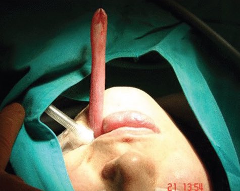 Keith Siau tweet media