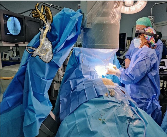 Mixed reality holograms for percutaneous lead extraction of cardiac implantable electronic devices
lnkd.in/gxbkF3b4

Valverde, I. et al. Mixed reality holograms for percutaneous lead extraction of cardiac implantable electronic devices. Virtual Reality 28, 21 (2024).