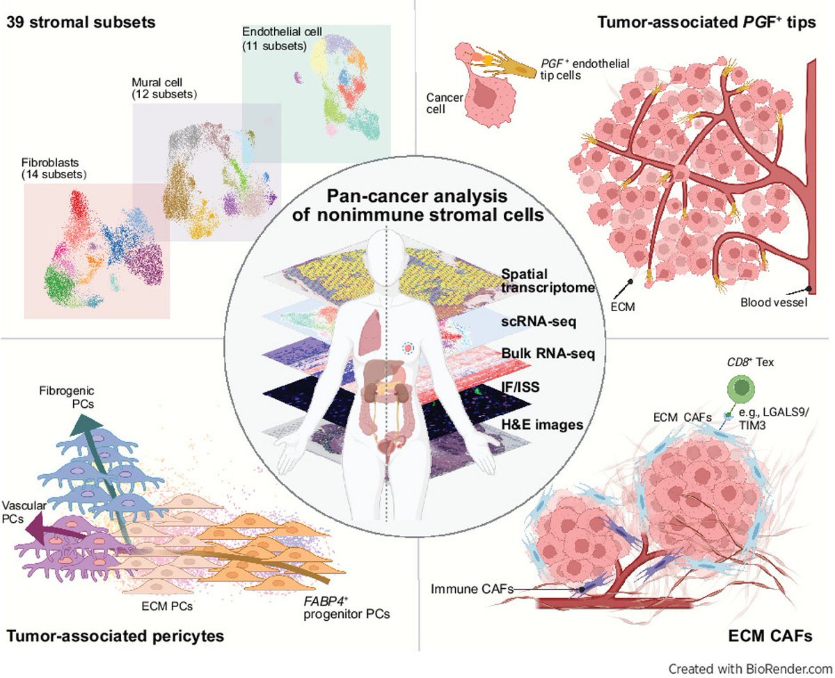 New resource report in the January 15th issue—
Integration of #PanCancer #SingleCell and Spatial Transcriptomics Reveals Stromal Cell Features and Therapeutic Targets in Tumor Microenvironment, by Yanhua Du et al.
bit.ly/3S8d3j5