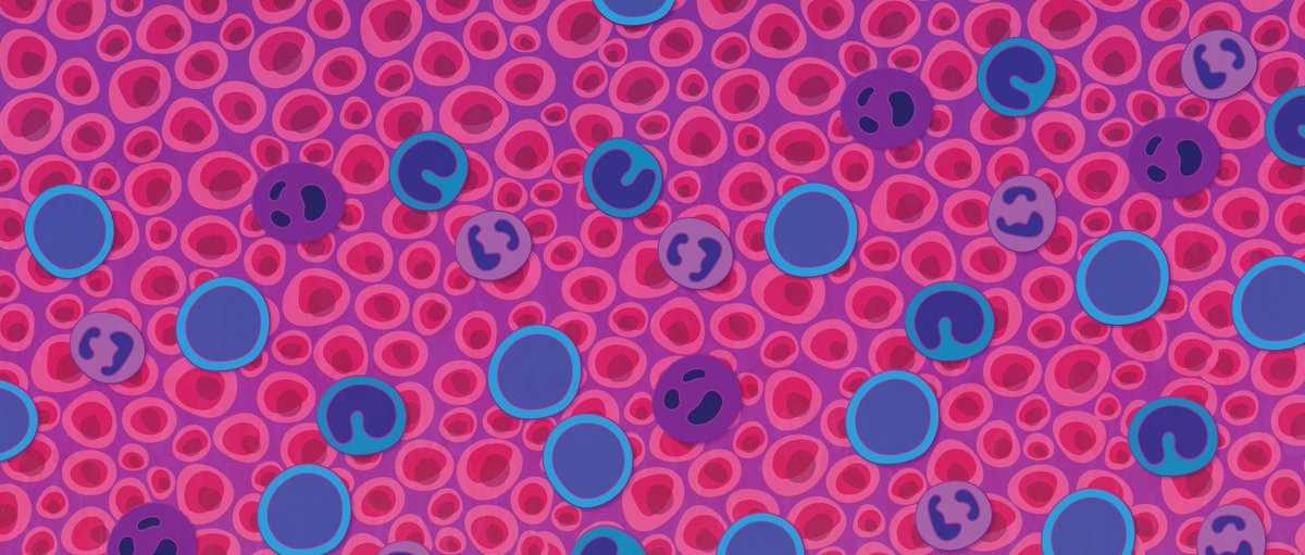 Cancer Discovery (@cd_aacr) on Twitter photo #OnlineFirst: Jak2V617F Reversible Activation Shows Its Essential Requirement in #MyeloproliferativeNeoplasms, by <a href="/JAK2TheFuture/">Andrew Dunbar</a>, @bowman_rl, <a href="/rosslevinemd/">Ross Levine</a>, <a href="/RossLevineLab/">Ross Levine Lab</a> et al.
bit.ly/3S8gvdx
<a href="/MSKCancerCenter/">Memorial Sloan Kettering Cancer Center</a> #mpnsm #OnlineFirst: Jak2V617F Reversible Activation Shows Its Essential Requirement in #MyeloproliferativeNeoplasms, by <a href="/JAK2TheFuture/">Andrew Dunbar</a>, @bowman_rl, <a href="/rosslevinemd/">Ross Levine</a>, <a href="/RossLevineLab/">Ross Levine Lab</a> et al.
bit.ly/3S8gvdx
<a href="/MSKCancerCenter/">Memorial Sloan Kettering Cancer Center</a> #mpnsm