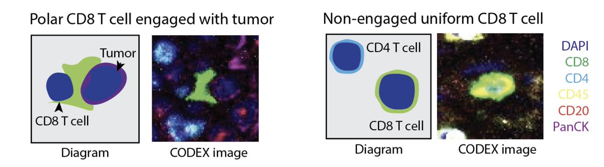 James Zou (@james_y_zou) on Twitter photo Introducing PEPSI🥤, our new method to identify tumor-immune cell interactions from tissue imaging. Incorporating this interaction helps predict how patients respond to cancer therapies.
#PSB paper psb.stanford.edu/psb-online/pro…
Great job by <a href="/ericwu93/">Eric Wu</a> collaborating w/ <a href="/EnableMedicine/">Enable Medicine</a>! Introducing PEPSI🥤, our new method to identify tumor-immune cell interactions from tissue imaging. Incorporating this interaction helps predict how patients respond to cancer therapies.
#PSB paper psb.stanford.edu/psb-online/pro…
Great job by <a href="/ericwu93/">Eric Wu</a> collaborating w/ <a href="/EnableMedicine/">Enable Medicine</a>!