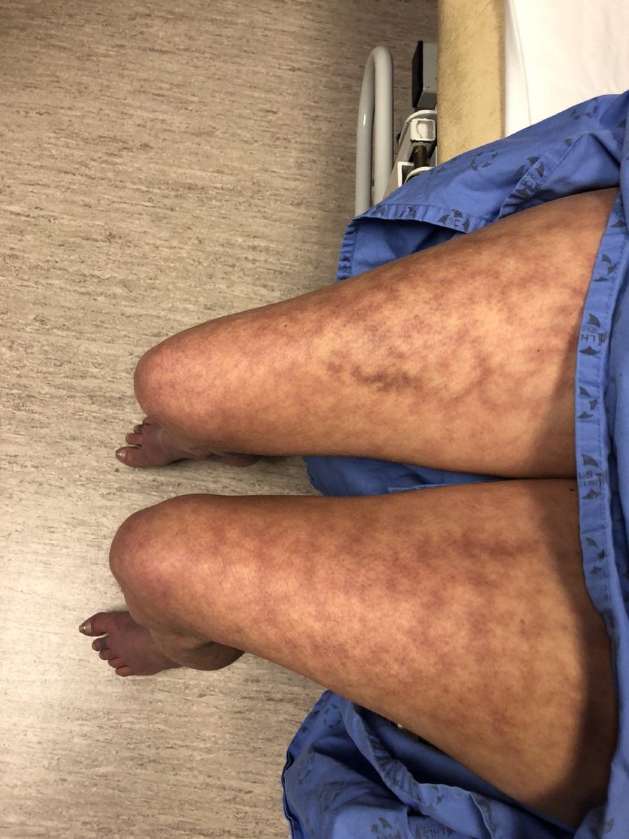 BrownJHM's tweet photo. Diagnosis? H/t @Janetbirdope #MedEd https://t.co/vEnwyBaocs