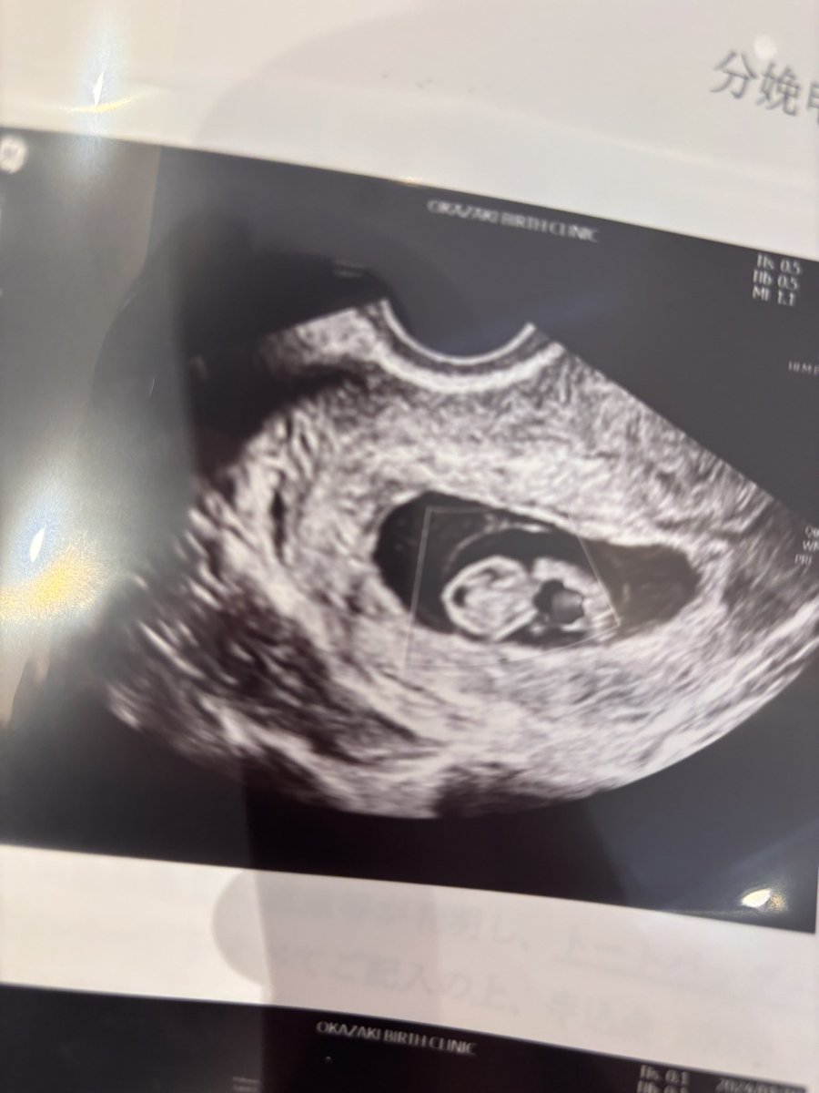 SAW(そう) tweet media