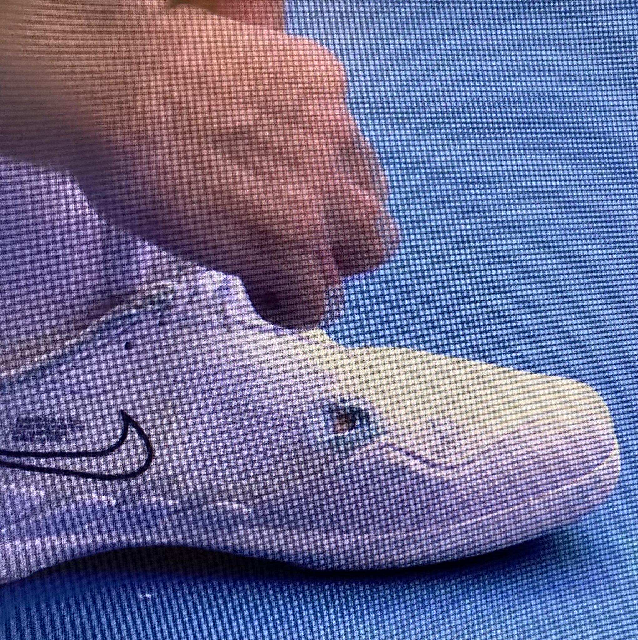 Nike broken shop shoe